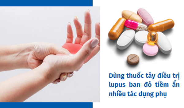 Khi dùng thuốc tây điều trị lupus ban đỏ có thể gặp tình trạng mệt mỏi, chân tay bứt rứt, khó chịu